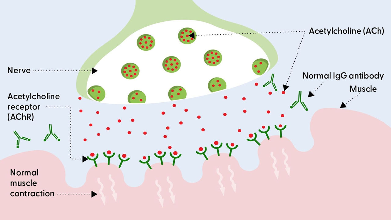 The neuromuscular junction without MG